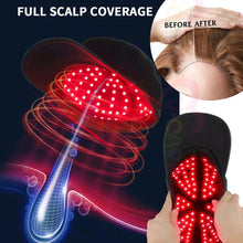 將圖片載入圖庫檢視器 VOCA - VC Red Light Therapy Cap with 150 LEDs for Improved Blood Flow and Hair Growth
